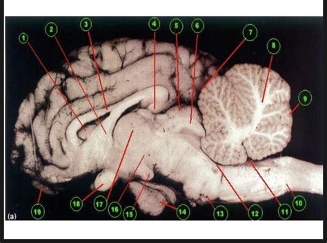 Brain Diagram Part 2 Diagram Quizlet