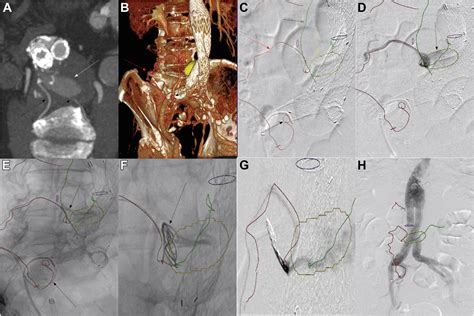 Image Guidance Techniques And Treatment Approach Optimization In The