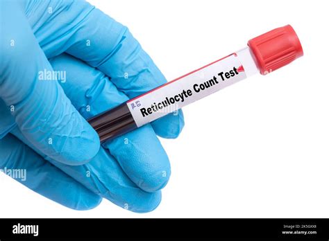 Reticulocyte Count Test Medical Check Up Test Tube With Biological