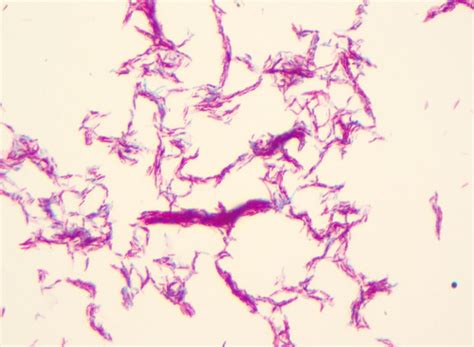 Rhodobacter Gram Stain