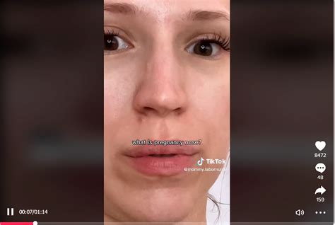 Pregnancy Nose What Is It And Why Does It Happen