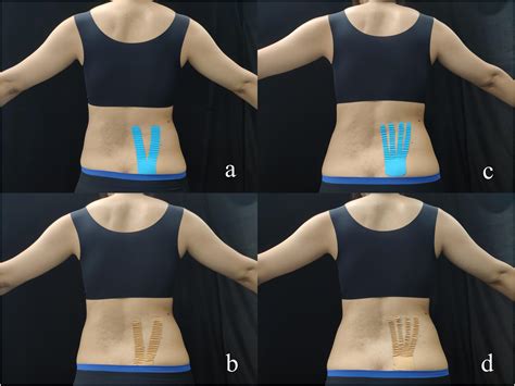 Frontiers Short Term Effect Of Different Taping Methods On Local Skin