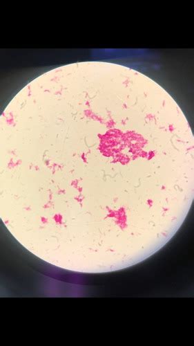 Lab2 Acid Fast Stain And Capsule Stain Flashcards Quizlet