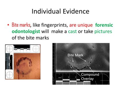 Individual Evidence Bite Marks Like Fingerprints Are Unique Forensic