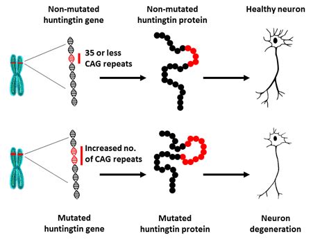 About Huntingtons Disease European Huntington S Disease Network