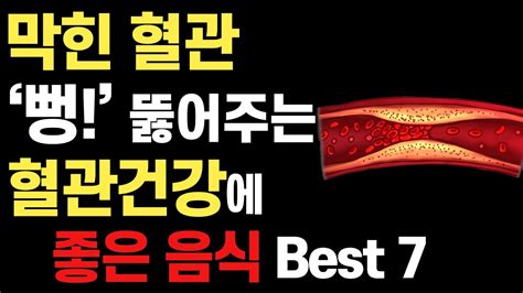 막힌 혈관 뻥 뚫어주는 혈액 순환에 좋은 음식 Best7 Youtube