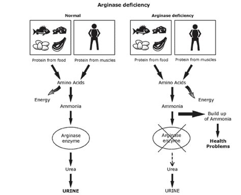 Argininemia/arginase deficiency – newbornscreening.info