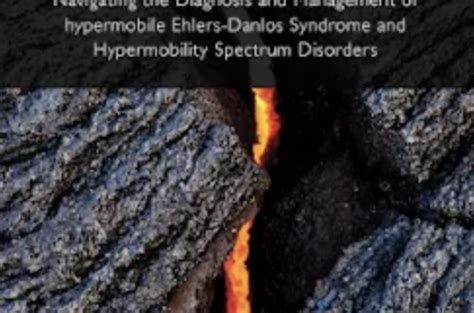 Books On Ehlers Danlos Syndrome Karina Sturm