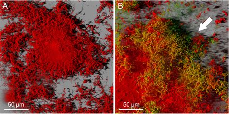 Three Dimensional Reconstructed Images Of S Mutans Biofilm Stained