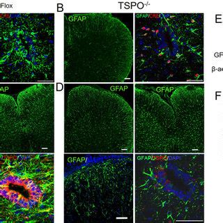 GFAP Expression In The CNS In Normal Mice And During EAE GFAP