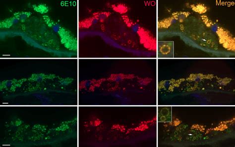 Mature Amyloid Fibrils Are Present In A Subset Of A Positive Vesicles