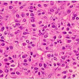 Liver Section H And E X400 Showing Normal Histological Features