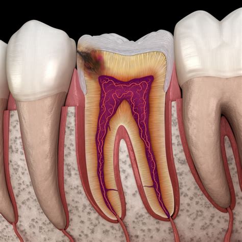 Cedric C Chenet Dds Blog