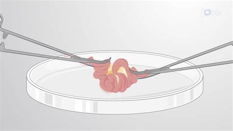 Whole Mount Preparation Of Mouse Intestine Using A Simple Gut Incising