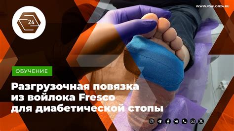 Разгрузочная повязка из войлока Fresco для диабетической стопы - YouTube
