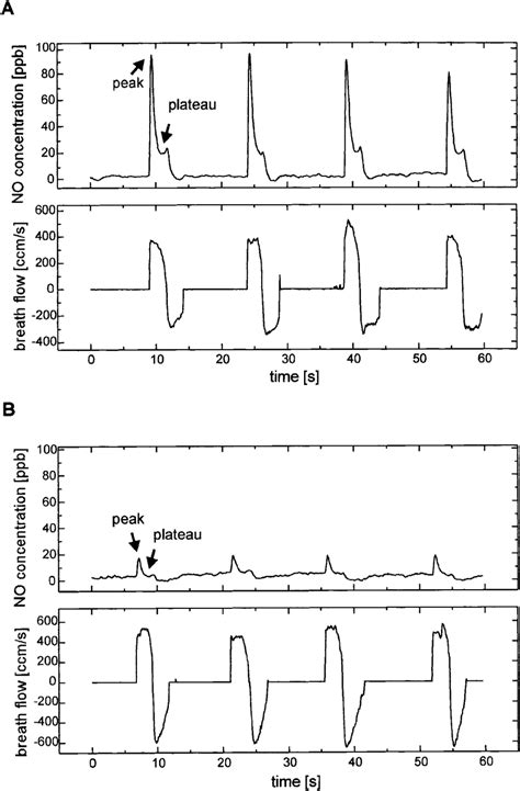 Measurement of nitric oxide (NO) concentration and breath flow for ...