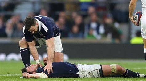 Rugbys Concussion Reviews Are ‘not Fit For Purpose Says Brain Expert