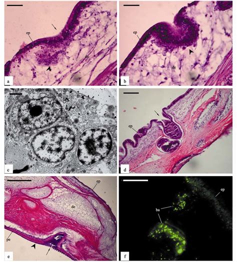 Formation of blastema-like structures during the regeneration of ...