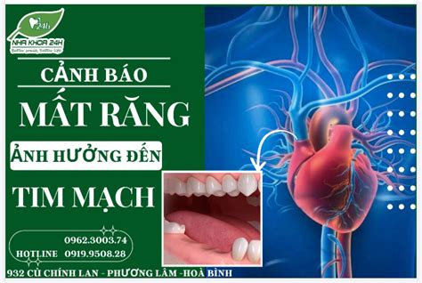 CẢNH BÁO TIỀM ẨN NGUY CƠ MẮC BỆNH TIM MẠCH DO MẤT RĂNG