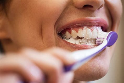 Além de escovar os dentes conheça 5 cuidados essenciais para manter