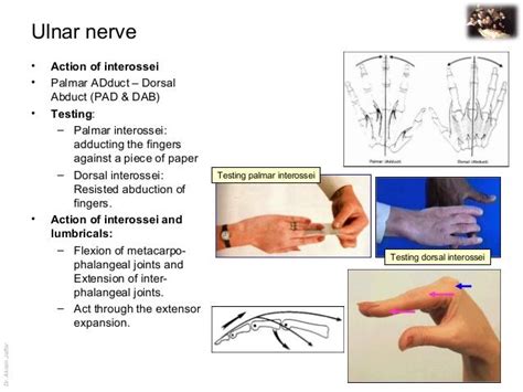 Applied anatomy ulnar nerve injury