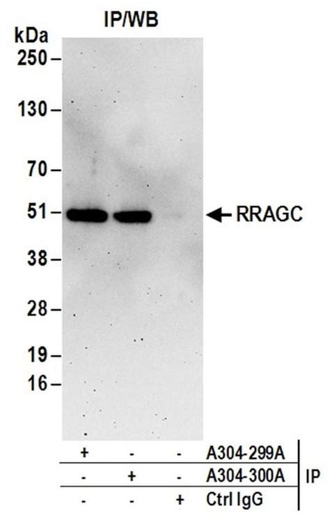 Rragcragc Polyclonal Antibody A304 300a