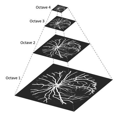 Scale Invariant Feature Transform Sift