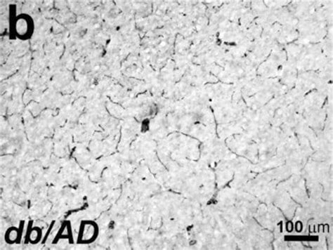 Smooth-muscle-antibody-positive | Sigma-Aldrich