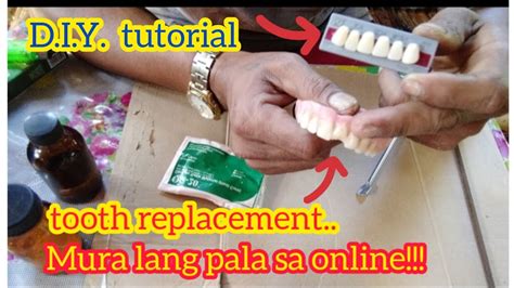 Pamalit Sa Natanggal Na Ngipin Ng Postiso Mura Lang Pala Sa Online D