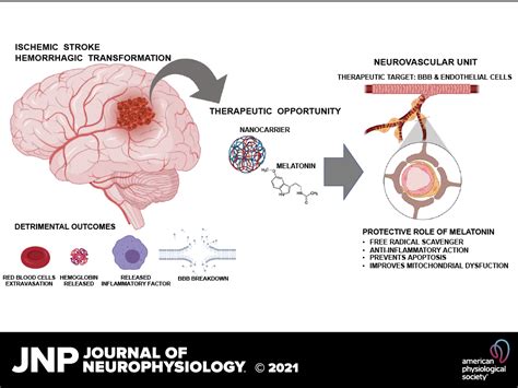 Hemorrhagic Stroke Pathophysiology