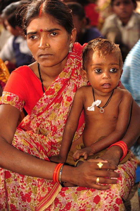 India Eight Malnourished Indian Children Of The Kol Tribe Face Death