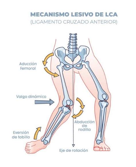 Clase Digital Lesiones De Rodilla Y Su Presentaci N Cl Nica