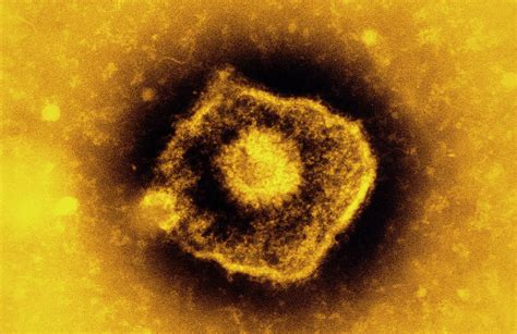 Coloured Tem Of Varicella Zoster Virus Photograph By Heather Davies