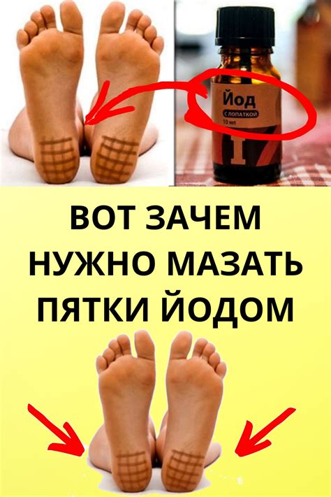 Pin on Здоровье