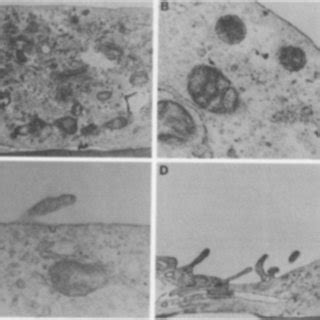 Transmission Electron Microscopy Of Human Glomerular Endothelial Cells