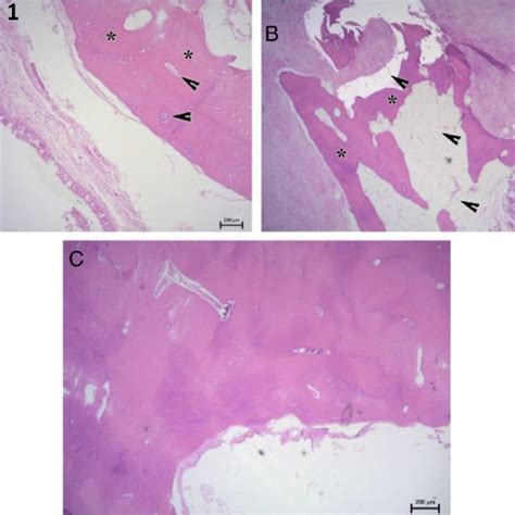 Histopathology Findings Show A Mature Bone Tissue With Concentric