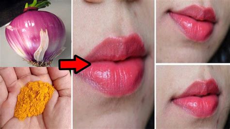 Get Soft Pink Lips Instantly Permanently 100 Works At Home YouTube