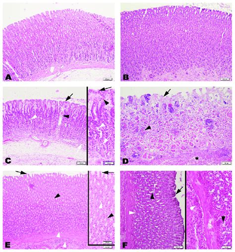 Micrographs illustrating the histological appearances of gastric ...