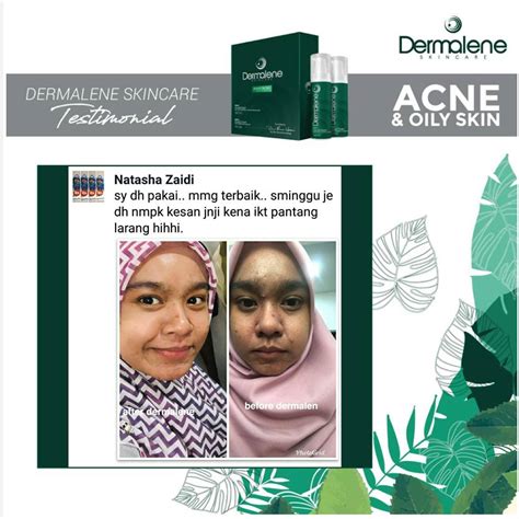 Buy Ikhrah Dermalene Acne Oil Skin Skincare Set By Dr Alina Hasni