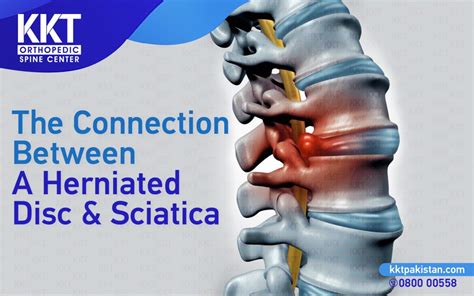 The Connection Between A Herniated Disc And Sciatica Kkt Pakistan