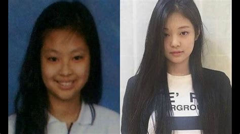 Jennie Blackpink Before Surgeryyou Will Be Shocked 😲😲 Youtube