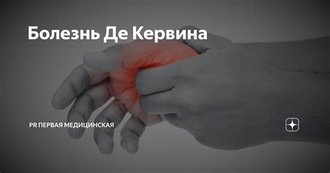 Болезнь Де Кервина | Первая Медицинская Клиника | Дзен