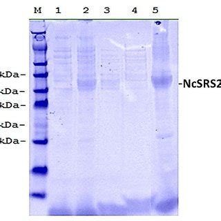 6 SDS PAGE GEL SHOWING EXPRESSION AND SOLUBILITY OF RECOMBINANT