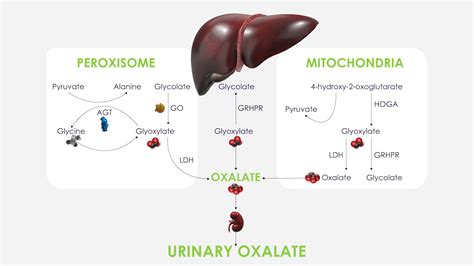 Ph1 Overview Primary Hyperoxaluria Type 1