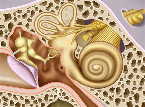 Superior Canal Dehiscence Uci Head And Neck Surgery Uci Ent Doctors Otolaryngologists