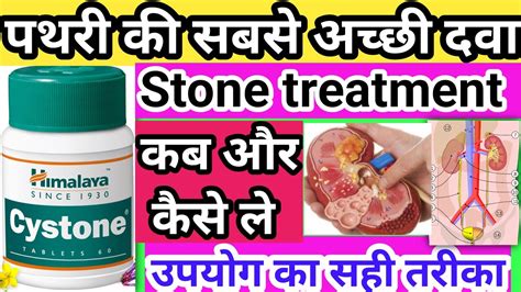 Cystone Tablet Ke Fayde Himalaya Cystone Tablet Cystone Tablet Uses