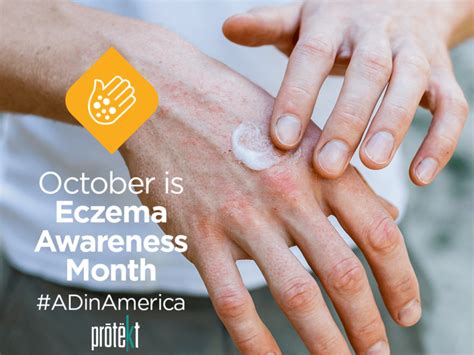 October Is National Eczema Awareness Month • External Use Probiotic Education