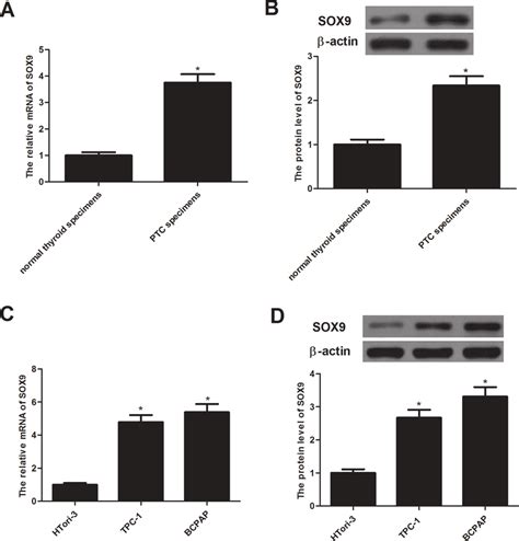 Expression Of Sox In Human Papillary Thyroid Cancer Tissue Specimens