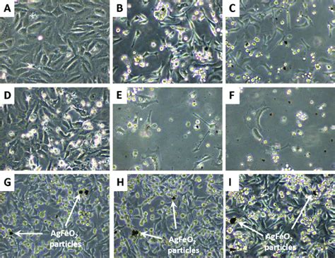 Morphology Of The Hela Cells A Before Treatment B After Treatment