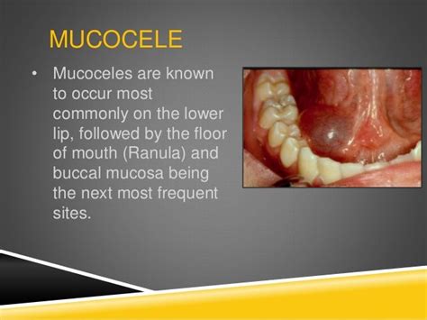 Summary Pediatric Oral Pathology